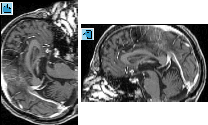 Sagittal Views