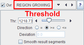 P3D Region Growing