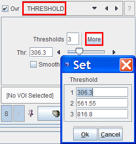 P3D Threshold Segmentation