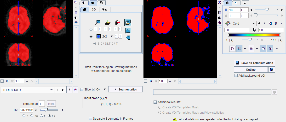 External Tool Segmentation