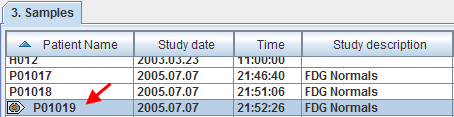 Indication of Normalized Controls