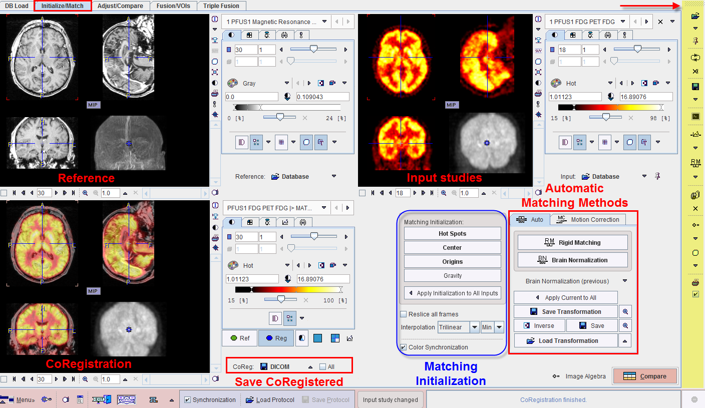 PFUS GUI1