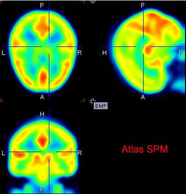 Atlas SPM