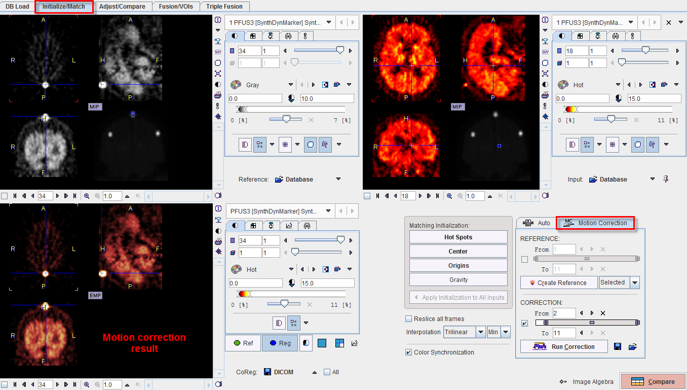 Result of Motion Correction