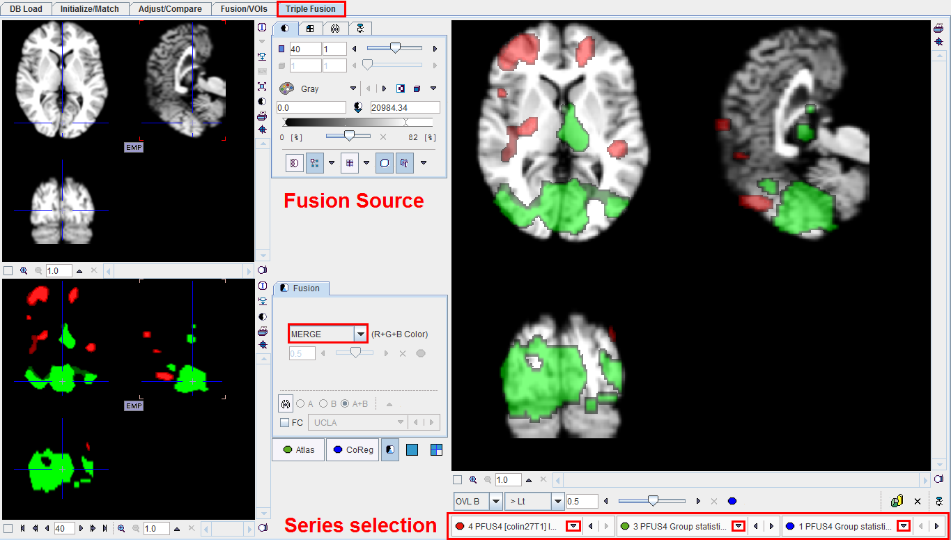 PFUS 3 Source Fusion