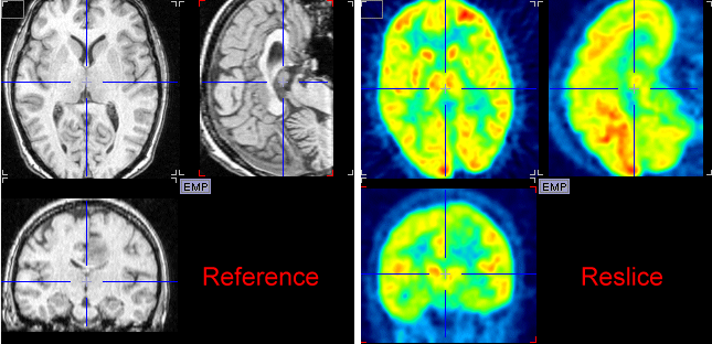 Set Origin for Initial Reslicing