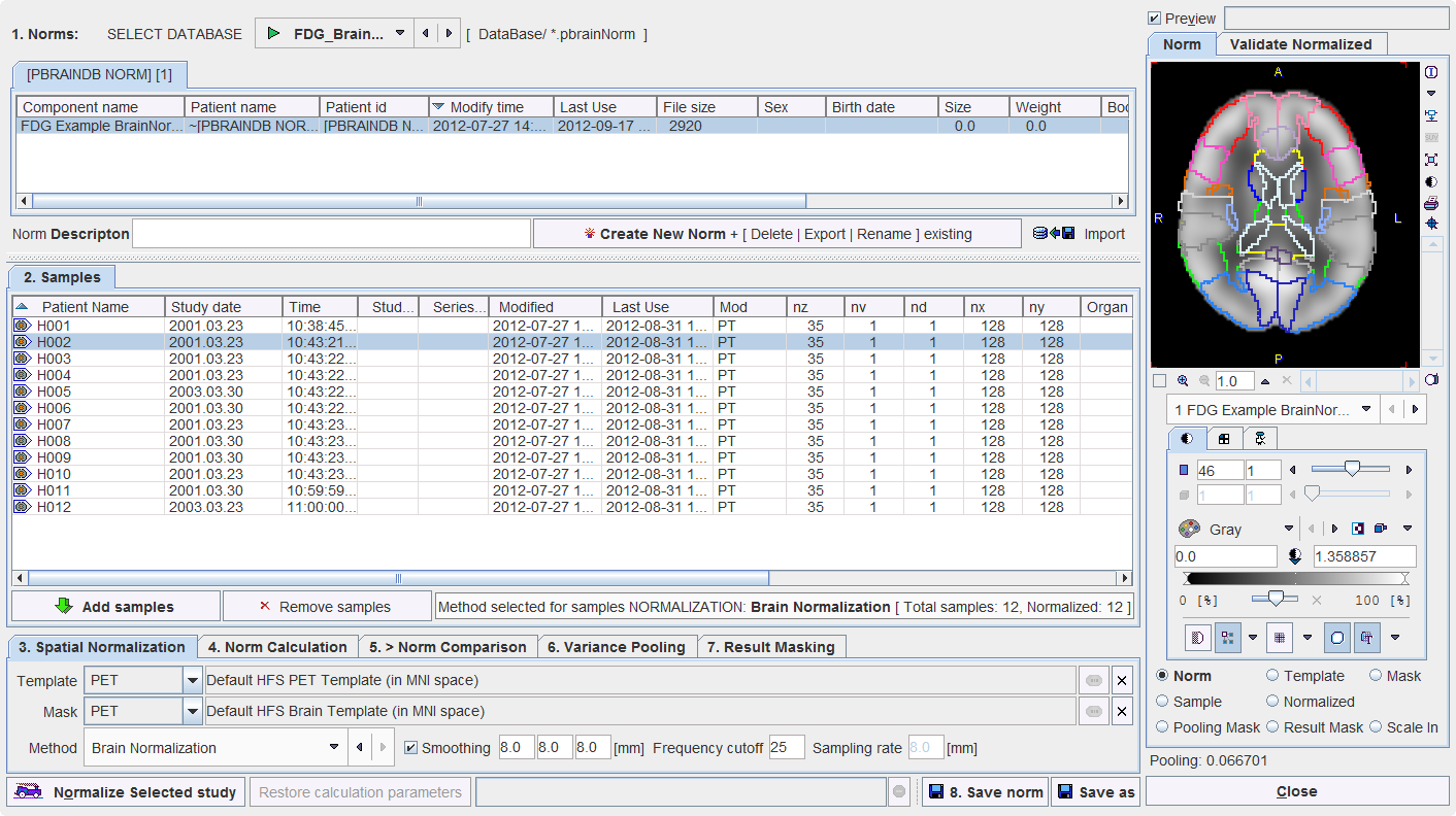 Brain DB Editor User Interface