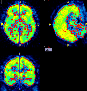 Isocontour Result