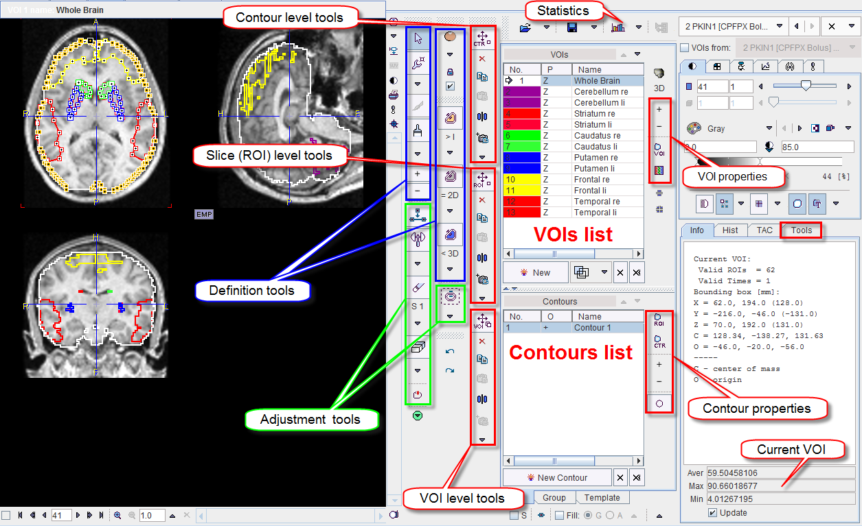 VOI Interface